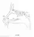 Fig. 366 - Robotic catheter system and methods