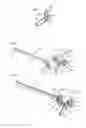Fig. 03 - EYE MARKER FOR EYE SURGERY