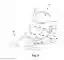 Fig. 08 - Surgical guide and method for guiding a therapy delivery device into the pterygopalatine fossa