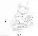 Fig. 09 - Surgical guide and method for guiding a therapy delivery device into the pterygopalatine fossa