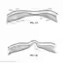 Fig. 02 - IMPLANT FOR HERNIA REPAIR