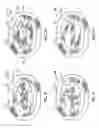 Fig. 05 - IMPLANT FOR HERNIA REPAIR