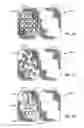 Fig. 08 - IMPLANT FOR HERNIA REPAIR