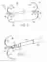 Fig. 02 - TACKING DEVICE