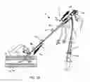 Fig. 08 - Apparatus and methods for sealing a vascular puncture