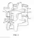 Fig. 04 - STRUCTURES AND METHODS FOR CONSTRAINING SPINAL PROCESSES WITH SINGLE CONNECTOR