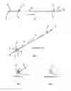 Fig. 02 - Method and apparatus for preparing and fusion of small joints