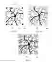 Fig. 04 - Fractal interconnects for neuro-electronic interfaces and implants using same