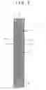 Fig. 03 - Stent and stent delivery system