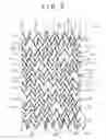 Fig. 08 - Stent and stent delivery system