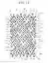 Fig. 10 - Stent and stent delivery system