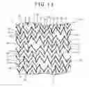 Fig. 11 - Stent and stent delivery system