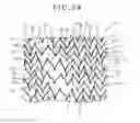 Fig. 13 - Stent and stent delivery system