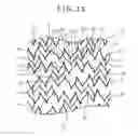 Fig. 15 - Stent and stent delivery system