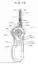 Fig. 25 - Stent and stent delivery system