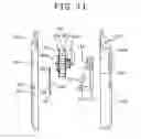 Fig. 27 - Stent and stent delivery system