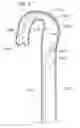 Fig. 28 - STABILITY DEVICE FOR USE WITH PERCUTANEOUS DELIVERY SYSTEMS