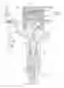 Fig. 01 - Defective-portion detector for fuel injection system