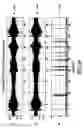 Fig. 40 - Dynamic enhancement of audio (DAE) in headset systems