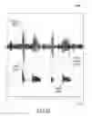 Fig. 50 - Dynamic enhancement of audio (DAE) in headset systems