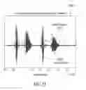 Fig. 53 - Dynamic enhancement of audio (DAE) in headset systems