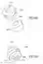 Fig. 56 - Dynamic enhancement of audio (DAE) in headset systems