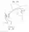 Fig. 166 - Biologically fit wearable electronics apparatus and methods