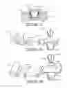 Fig. 04 - Plant package and methods of forming same using a thermoplastic flower pot