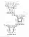 Fig. 09 - Plant package and methods of forming same using a thermoplastic flower pot