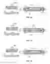 Fig. 07 - Breech guides for use with breech assemblies and firearms including such breech guides