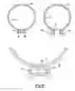 Fig. 06 - Retrofit injector mount