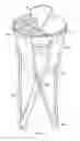 Fig. 02 - COLLAPSIBLE THERMAL CONTAINER AND STAND
