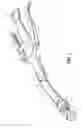 Fig. 02 - Tilting anvil for annular surgical stapler