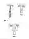 Fig. 03 - Tilting anvil for annular surgical stapler