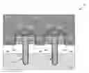 Fig. 01 - Trench MOSFET and method for fabricating same