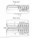 Fig. 18 - Semiconductor device, method for manufacturing semiconductor device, method for laminating semiconductor wafers, and electronic device
