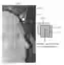 Fig. 01 - Multi-view rendering apparatus and method using background pixel expansion and background-first patch matching