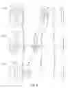Fig. 06 - Zoom lens
