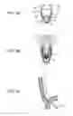 Fig. 04 - STROBE DEVICE AND IMAGE-CAPTURING DEVICE USING SAME