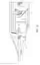 Fig. 13 - LEVEL LIFT DETACHABLE TRAILER SYSTEM