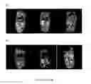 Fig. 03 - VERSATILE NANOPARTICULATE BIOMATERIAL FOR CONTROLLED DELIVERY AND/OR CONTAINMENT OF THERAPEUTIC AND DIAGNOSTIC MATERIAL