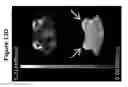 Fig. 25 - Loading technique for preparing radionuclide containing nanoparticles