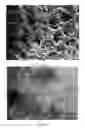 Fig. 02 - Method for alleviating the undesired side effects of dental bleaching