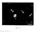 Fig. 15 - Stem cells, nucleotide sequences and proteins therefrom