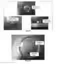 Fig. 07 - Compositions Comprising Peroxy alpha-Ketocarboxylic Acid and Methods For Producing and Using the Same