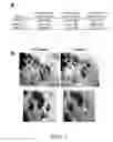 Fig. 02 - COMPOSITIONS AND METHODS FOR BIOACTIVE COATINGS TO IMPROVE ALLOGRAFT INCORPORATION