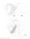 Fig. 02 - METHOD FOR THE REALIZATION OF BIOLOGICALLY COMPATIBLE PROSTHESIS