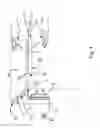 Fig. 02 - CONNECTING ARRANGEMENT BETWEEN A TOOTH PROSTHESIS AND AN IMPLANT POST