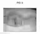 Fig. 09 - Cyclic implant perfusion, cleaning and passivation process and implant produced thereby