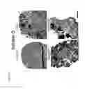 Fig. 06 - In situ tissue engineering using magnetically guided three dimensional cell patterning